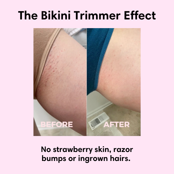 The Bikini Trimmer 2.0