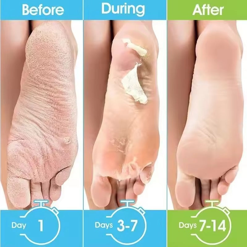 Foot Peeling Mask